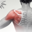 Shoulder Pain – What investigations should I order?