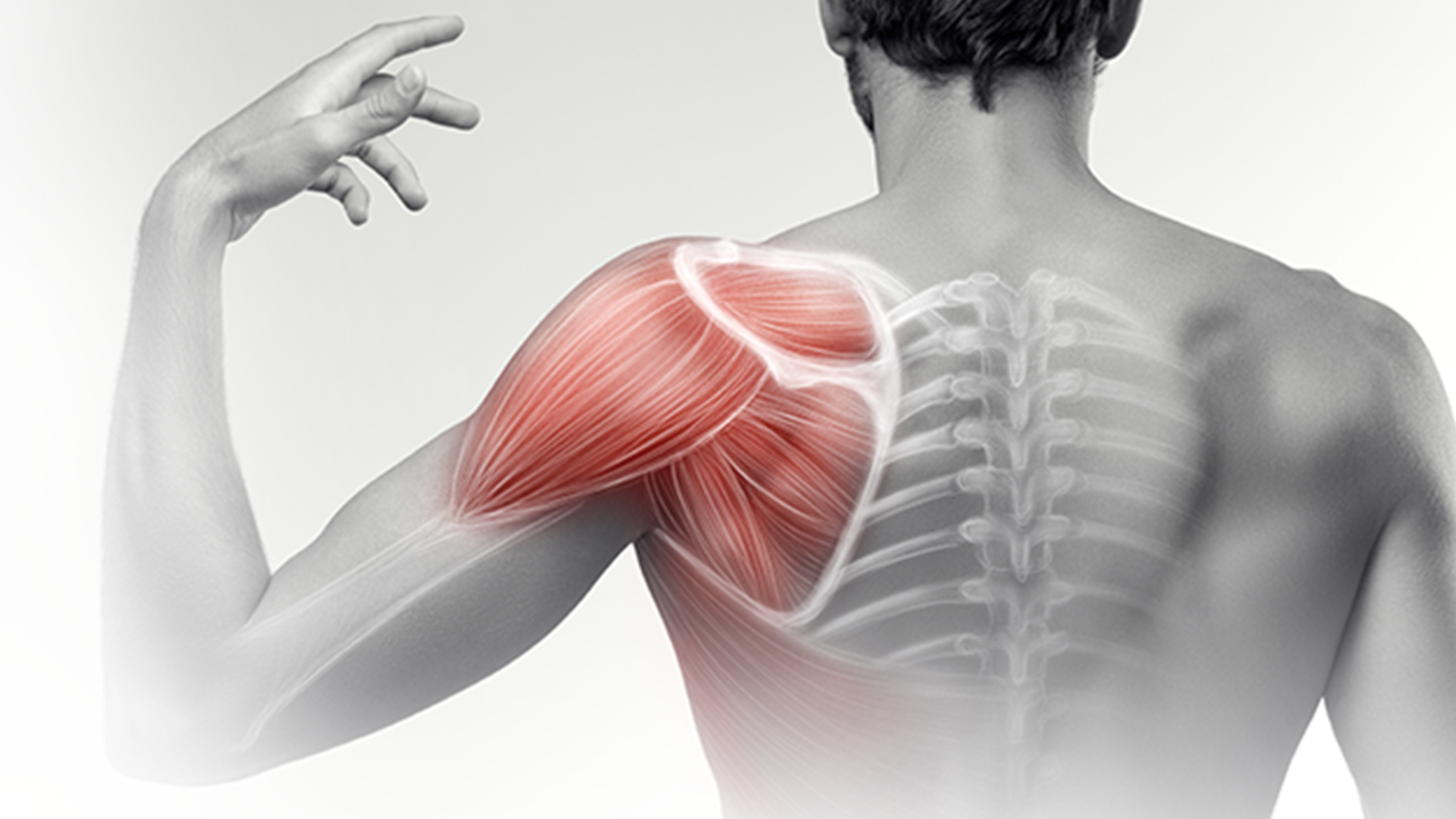 Shoulder Pain - What investigations should I order? - Sports Clinic NQ